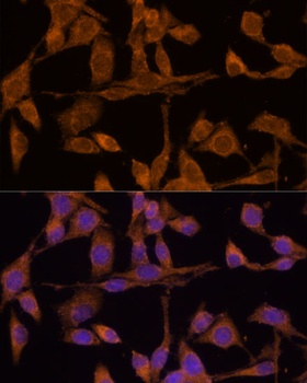 USP15 Antibody