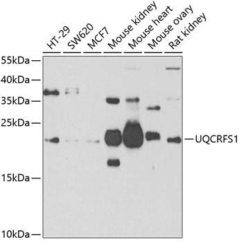 UQCRFS1 Antibody