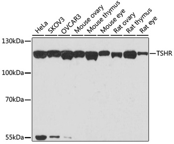 TSHR Antibody