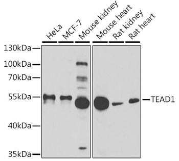 TEAD1 Antibody