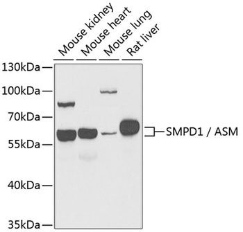 SMPD1 / ASM Antibody