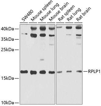 RPLP1 Antibody