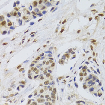 PPP1R8 Antibody