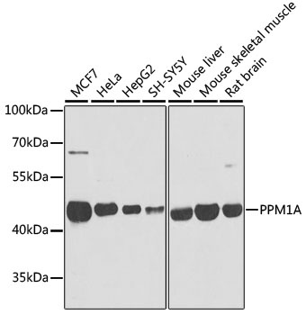 PPM1A Antibody