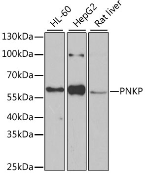 PNKP Antibody