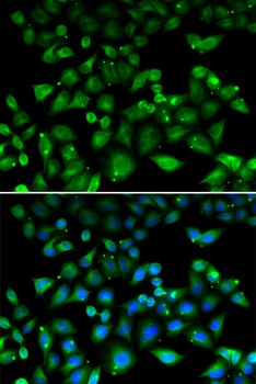 NHLRC1 Antibody