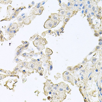 MMRN1 Antibody