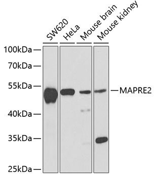 MAPRE2 Antibody