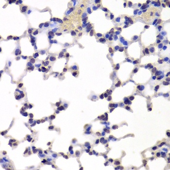 INTS6 Antibody