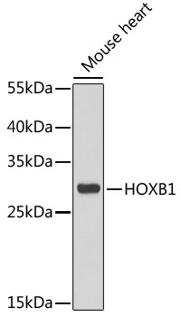 HOXB1 Antibody