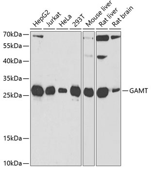 GAMT Antibody