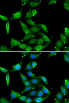GAMT Antibody