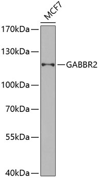 GABBR2 Antibody