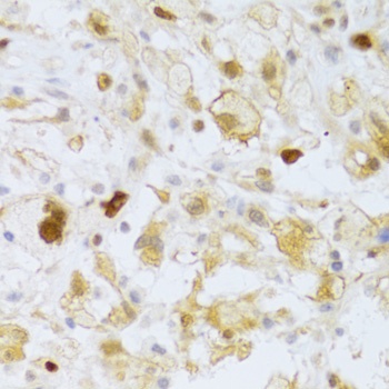 FCN1 Antibody