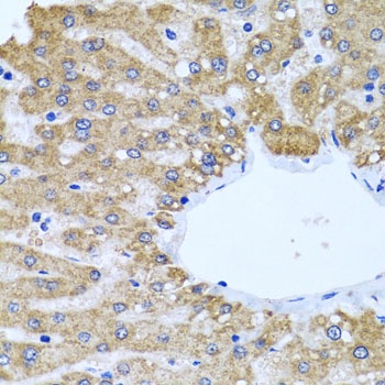 CCM2 Antibody