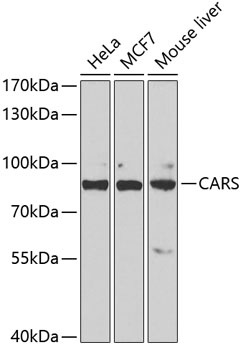 CARS Antibody