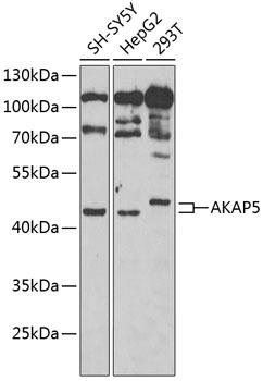 AKAP5 Antibody