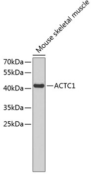 ACTC1 Antibody