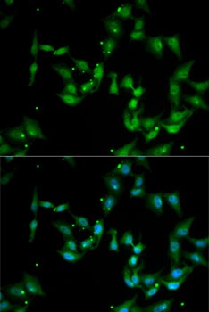 IL17F Antibody
