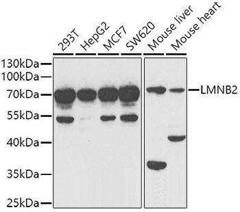 LMNB2 Antibody