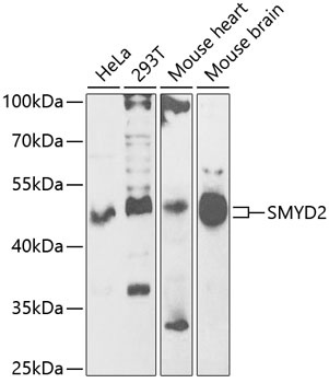 SMYD2 Antibody