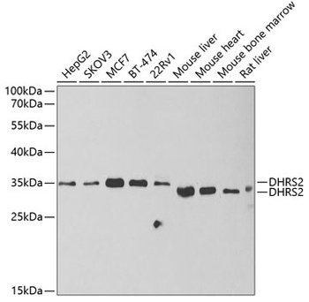 DHRS2 Antibody