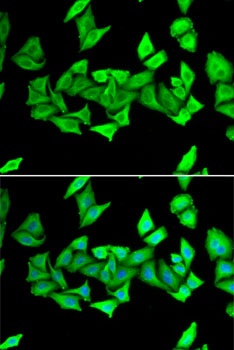 H6PD Antibody