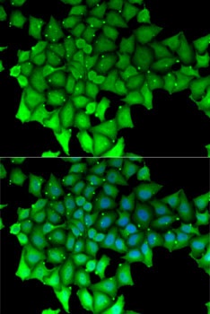RNGTT Antibody