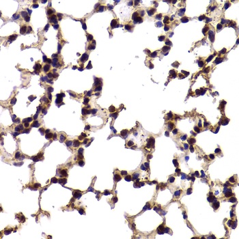 SF1 Antibody
