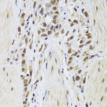 SF1 Antibody