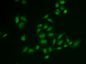 SSRP1 Antibody