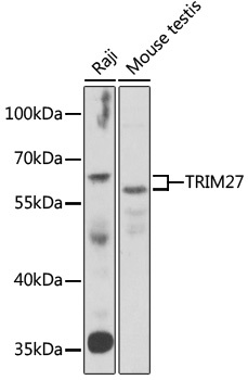 TRIM27 Antibody
