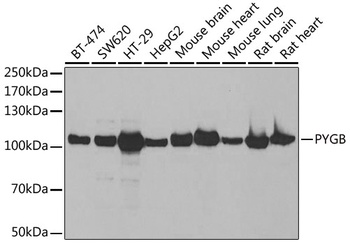 PYGB Antibody