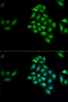 KLK10 Antibody
