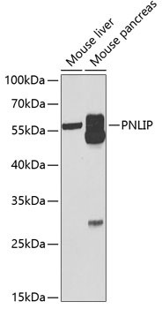 PNLIP Antibody