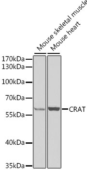 CRAT Antibody