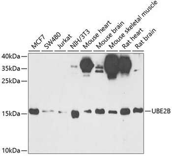 UBE2B Antibody