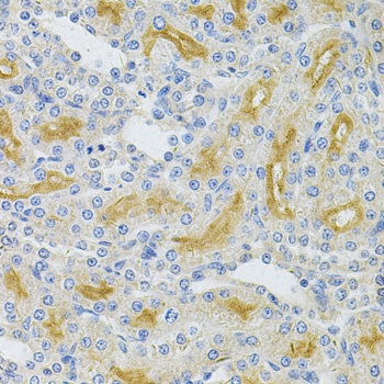 UBE2B Antibody