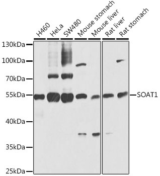 SOAT1 Antibody