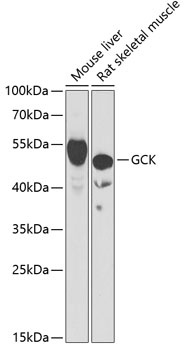 GCK Antibody