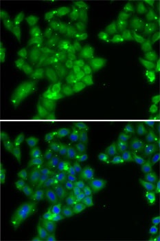 GCK Antibody