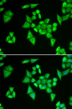ADSL Antibody