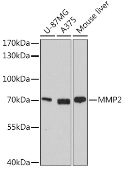 MMP2 Antibody