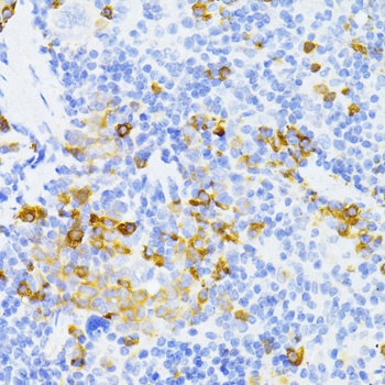 MMP2 Antibody