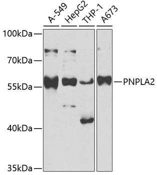 PNPLA2 Antibody