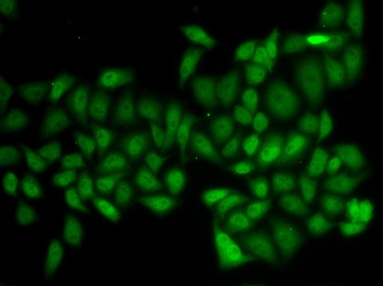 ATXN1 Antibody