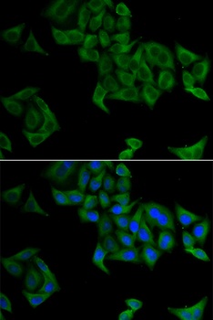 SMYD5 Antibody