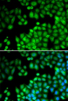 KMT2E Antibody