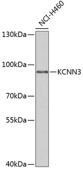 KCNN3 Antibody