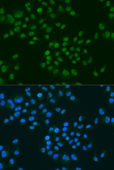 CIRBP Antibody